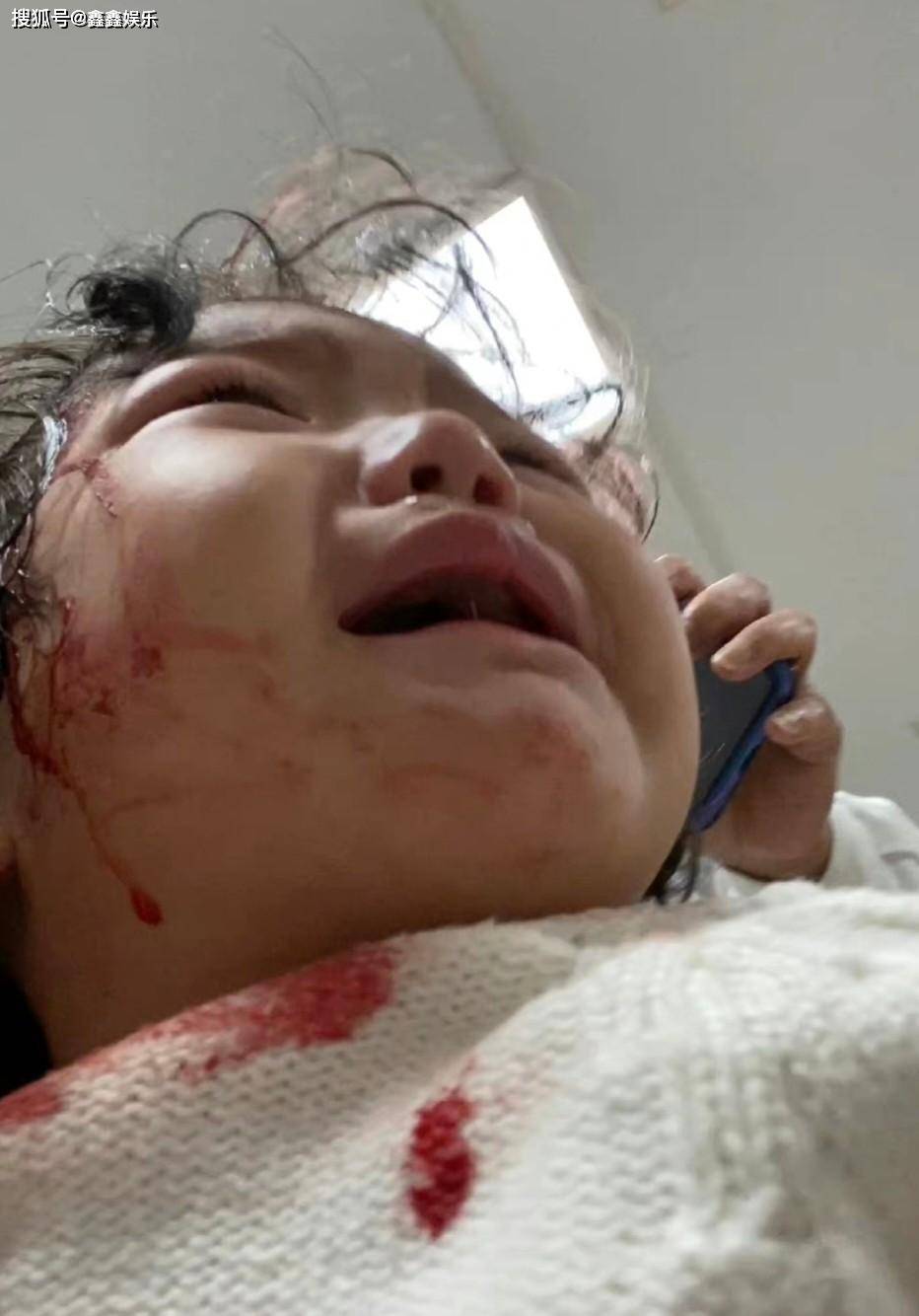 孩子头破血流老公脸受伤,玻璃碎一地_张兆艺_网友_事故