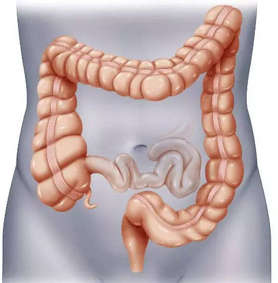 北京京医医院肿瘤科于加军:哪些人容易患结肠癌?治愈率有多高?