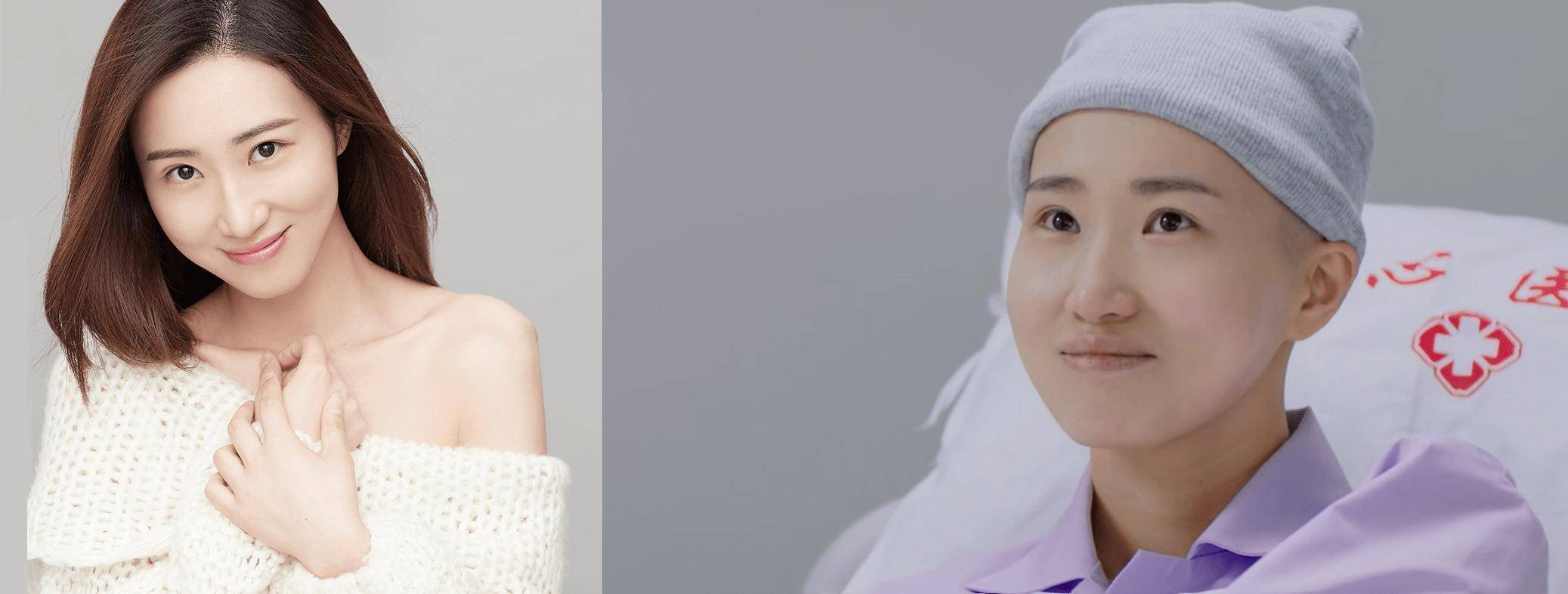 《你是我的城池营垒》曹苏苏为叶小满不惜剃光头出演,尽显职业素养