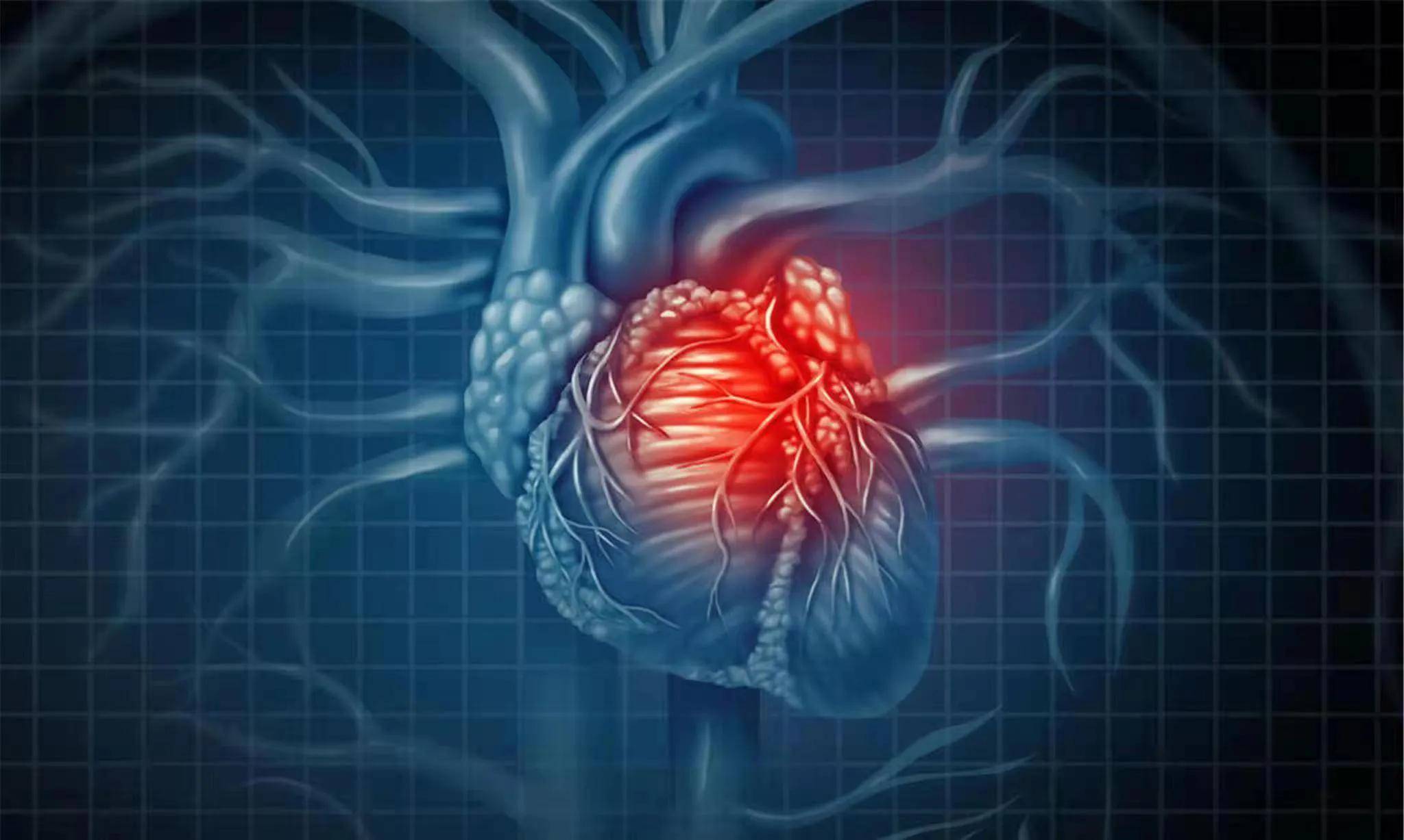 医生告诉您:如何养护心脏_治疗_患者_功能