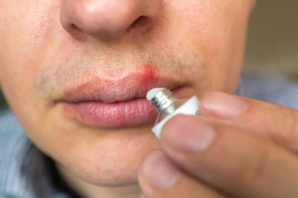 如果从多个方向刮,则会因为胡子太短,最终导致倒须的出现