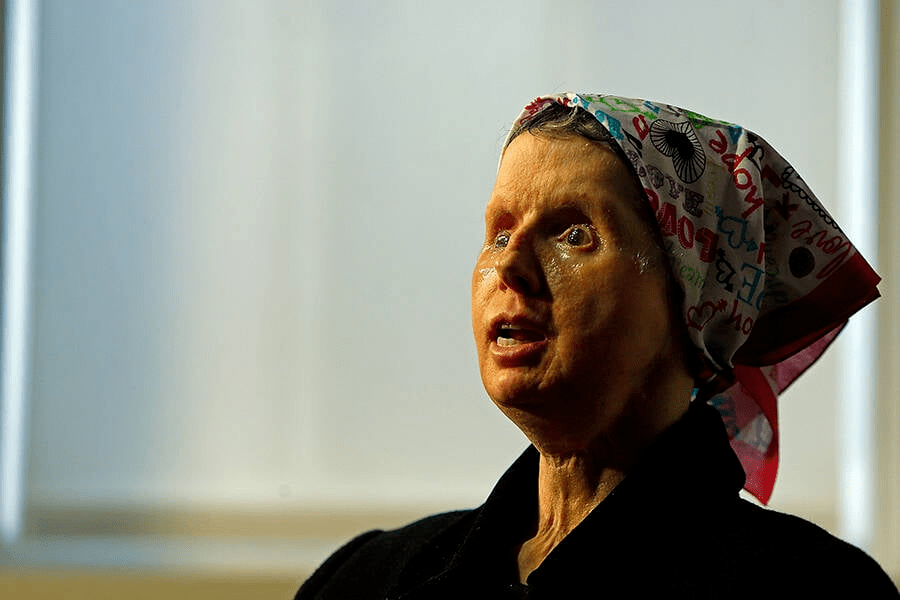 它正在吃她的脸!"