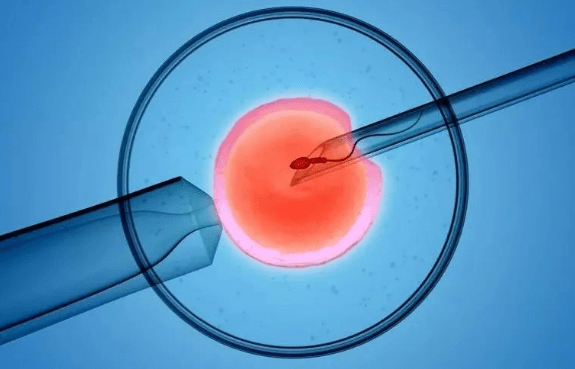 2,进周期日b超提示卵巢囊肿等异常,需暂停进周期,药物治疗或行囊肿