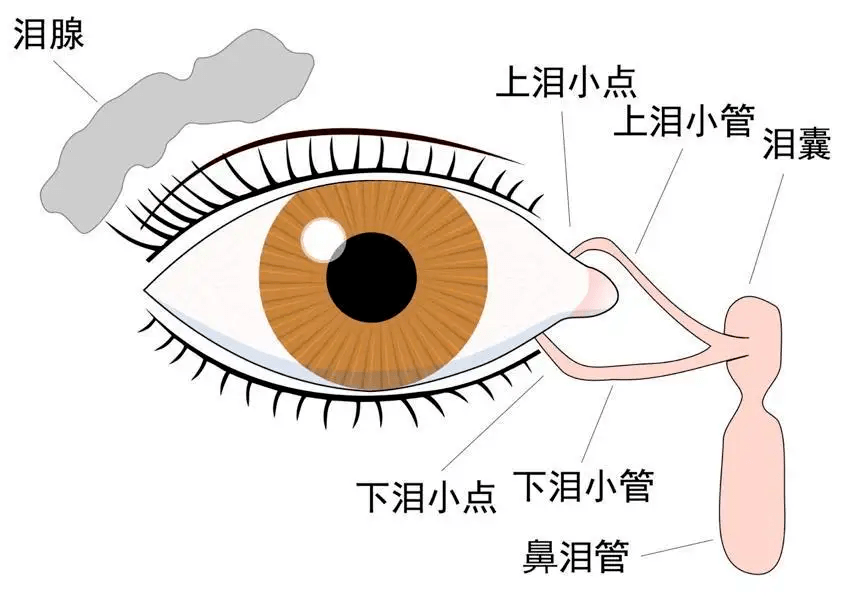 “眼屎”擦不净，反复治不好，原来是“泪小管炎”在作怪_泪道_治疗_专业