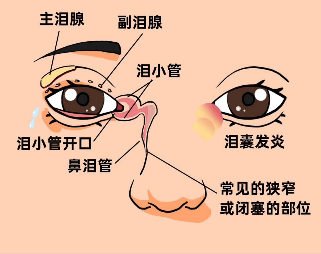 郴州市眼耳鼻喉医院眼科开展泪囊炎新技术