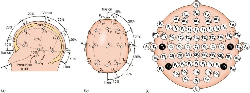 脑电图电极放置示意图图片