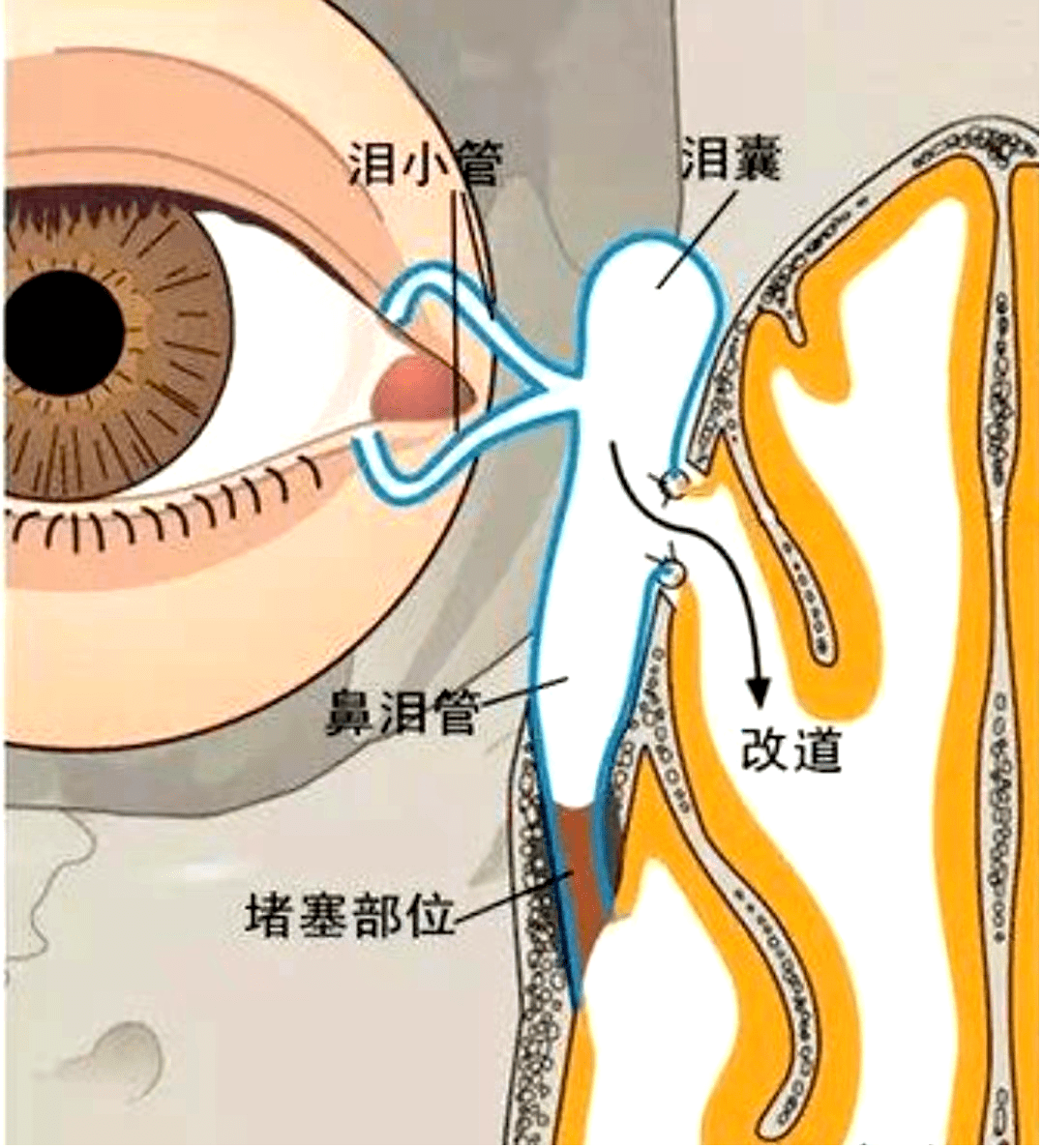 内眦泪囊部是哪个部位图片