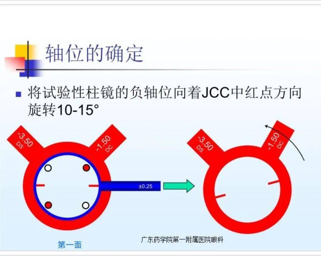 如何使用交叉柱镜精确散光轴位和度数_眼镜_检查_中国