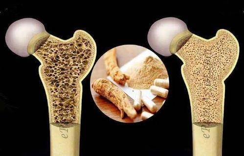 46岁男人保温杯泡枸杞,不幸瘫痪,医生感叹:骨头已烂成"蜂窝"_骨骼