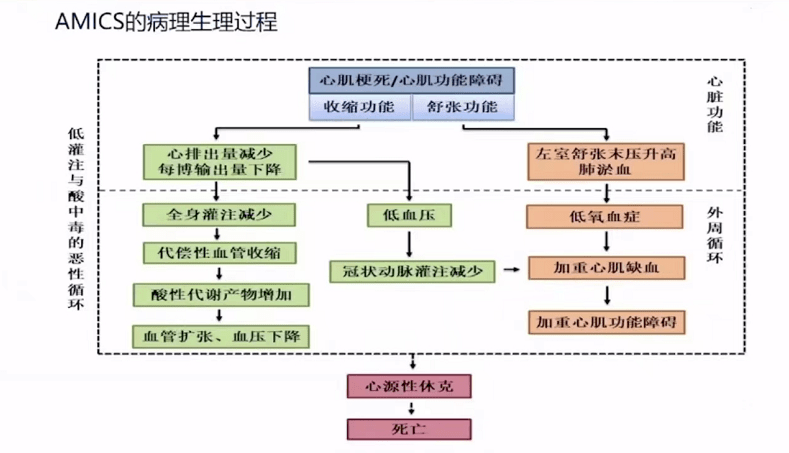 急性心肌梗死合并心原性休克(amics)发病率和死亡率均很高,但amics的