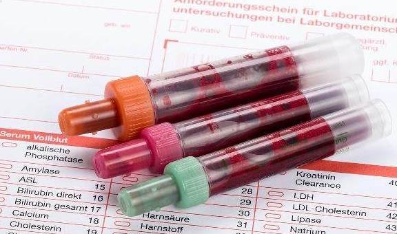 血常规化验单上的单核细胞是什么？