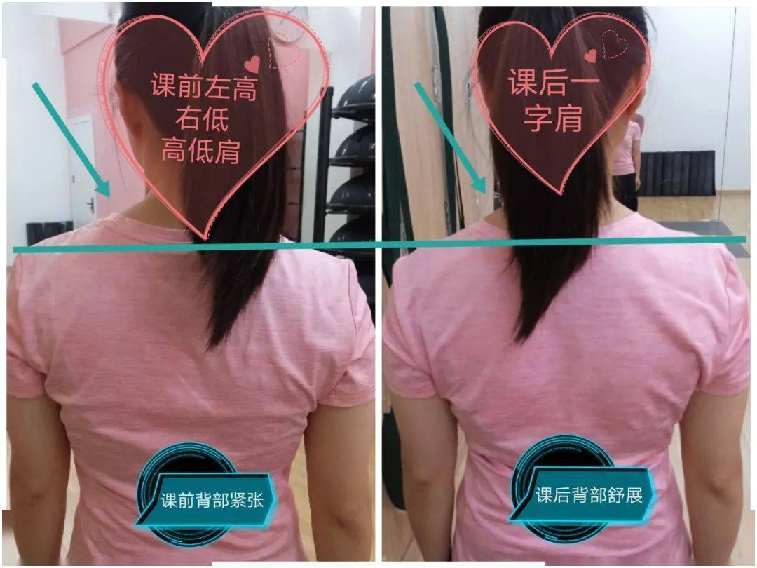 路人镜头下虎背熊腰八字腿好丑,网友惊呼:胖到裙子拉链拉不上_背部