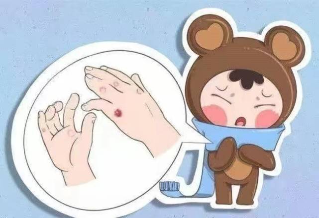 冬天手指又疼又痒?过来人有个方法简单又实用,7天红肿刺痒全消了!