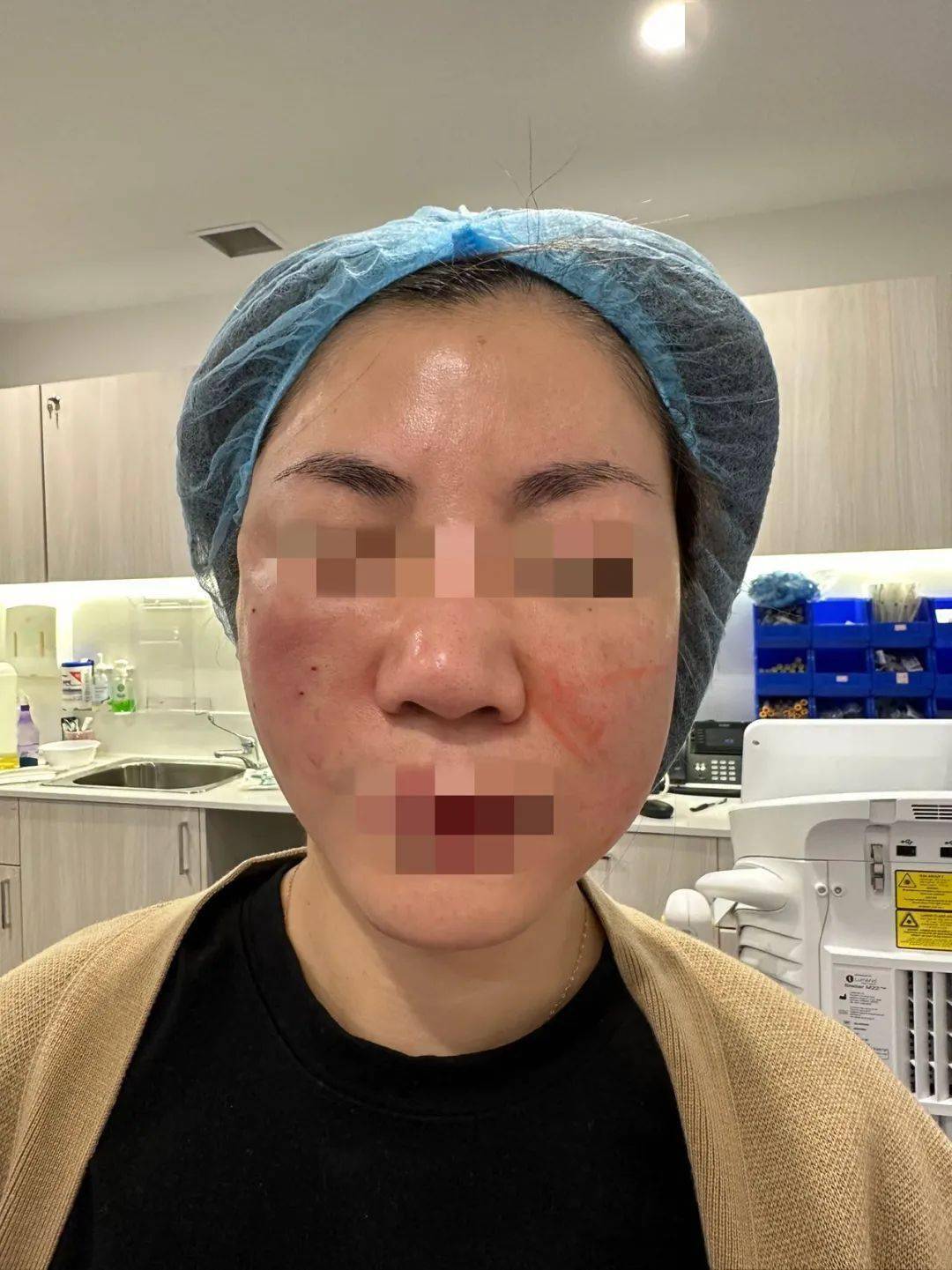 医疗美容事故再发,正规医美机构成为墨尔本爱美人士最高诉求!