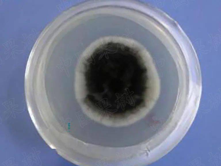 黑斑病菌落及孢子形态特征病原菌为链格孢,属于半知菌亚门丝孢纲丝梗