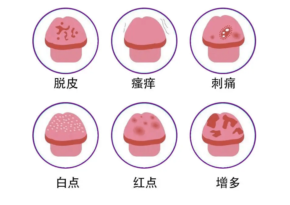丁丁发炎“盯上”你？是怎么引起的！_龟头_进行_包皮