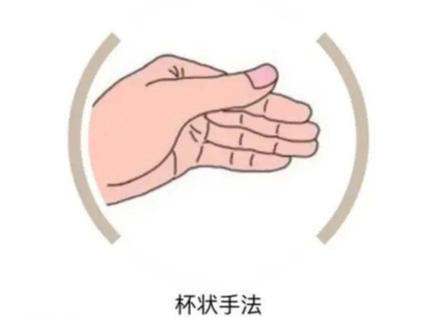 叩背手势94需要叩背:久病体弱,长期卧床,排痰不利拍背排痰虽有用这