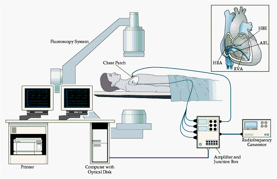 商丘市立医院carto三维电生理导航系统正式启用!_患者_定位_导管