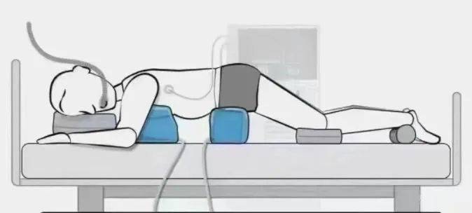 【科普】俯卧位通气