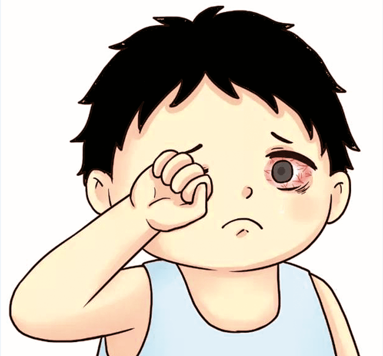 30岁男子高烧,眼睛红肿不停流泪.这难道是中了传说中的"哭株"?