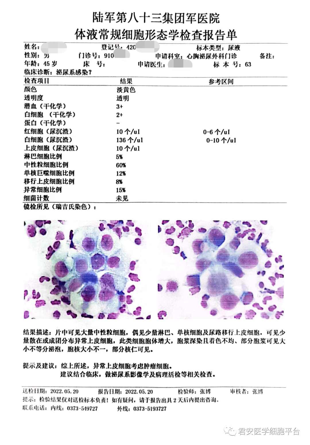 尿培养报告单图片图片