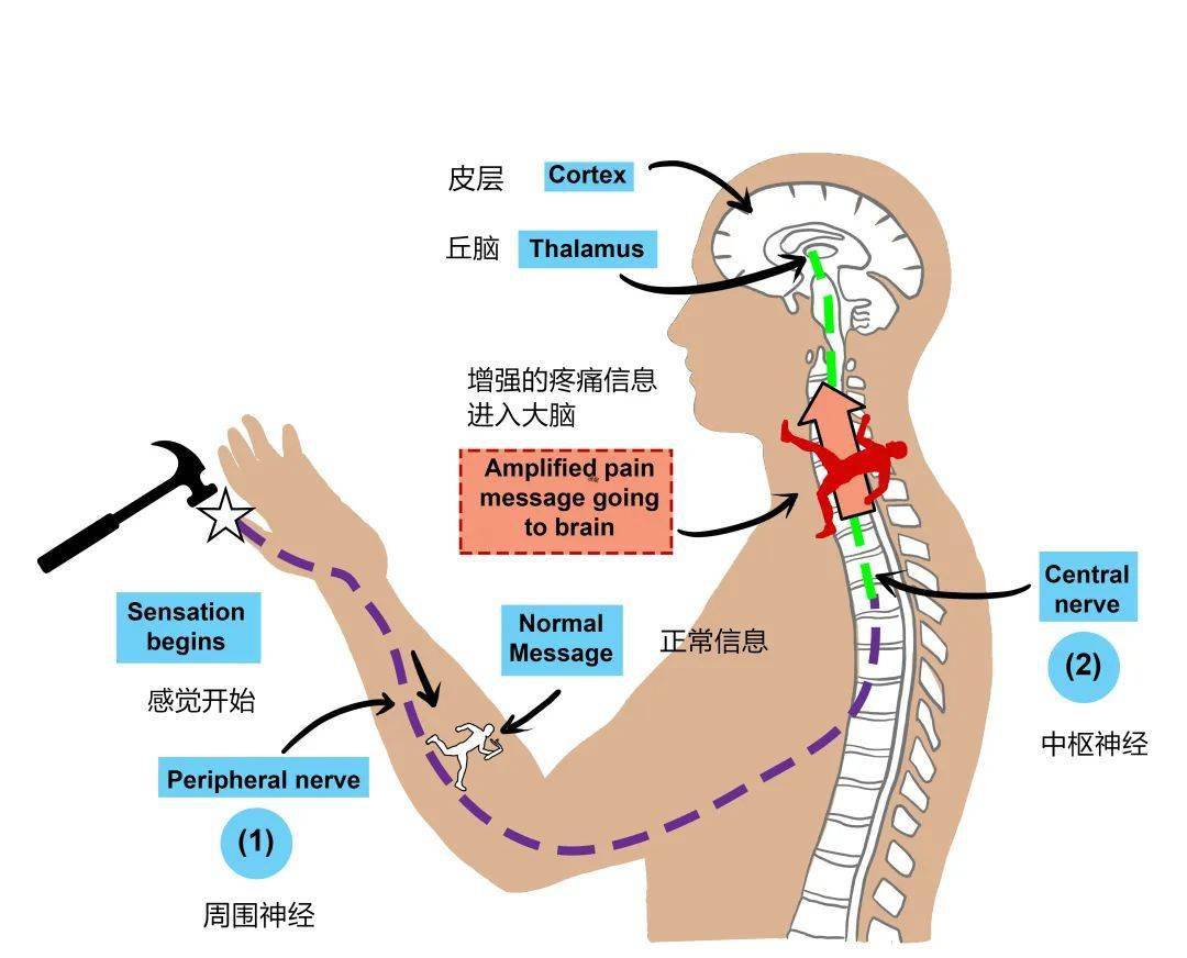 详讲瘢痕的疼痛和瘙痒症状_反应_纤维_通路