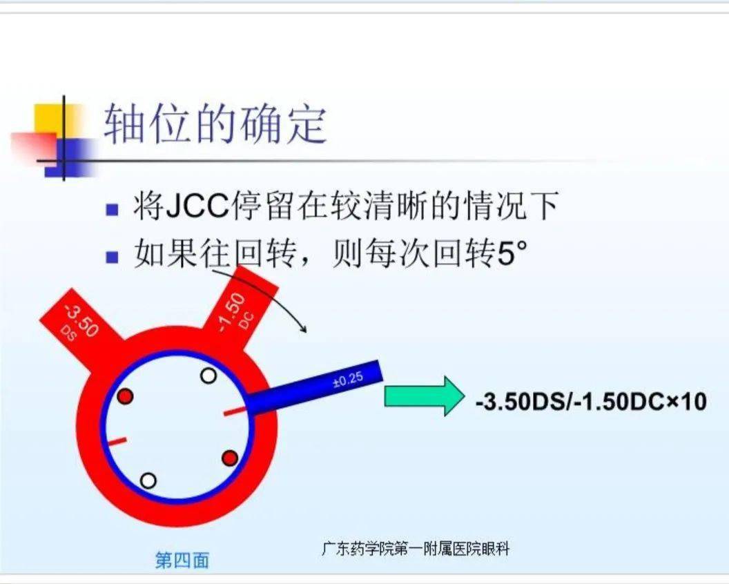 如何使用交叉柱鏡精確散光軸位和度數_中國_科技_眼鏡