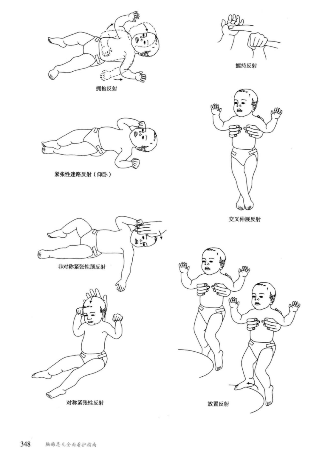 脑残认儿全面看护理指南pdf(美)米勒着