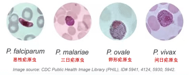 输血医学案例研究（3）血袋里的“蚊子”？