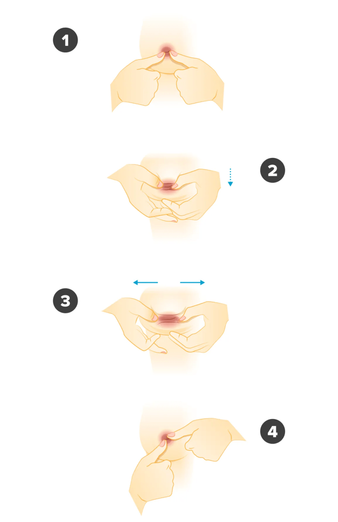 10岁儿童乳头内陷男童图片