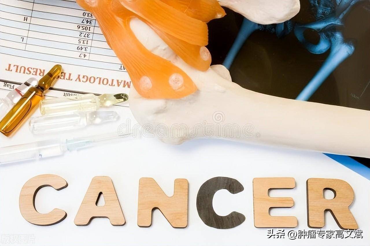 给肿瘤起名字的学问：不是所有的恶性肿瘤都叫“癌”_搜狐网