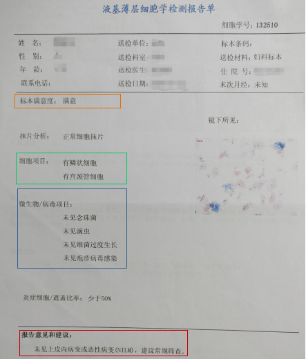 tct检查单子图片宫颈图片