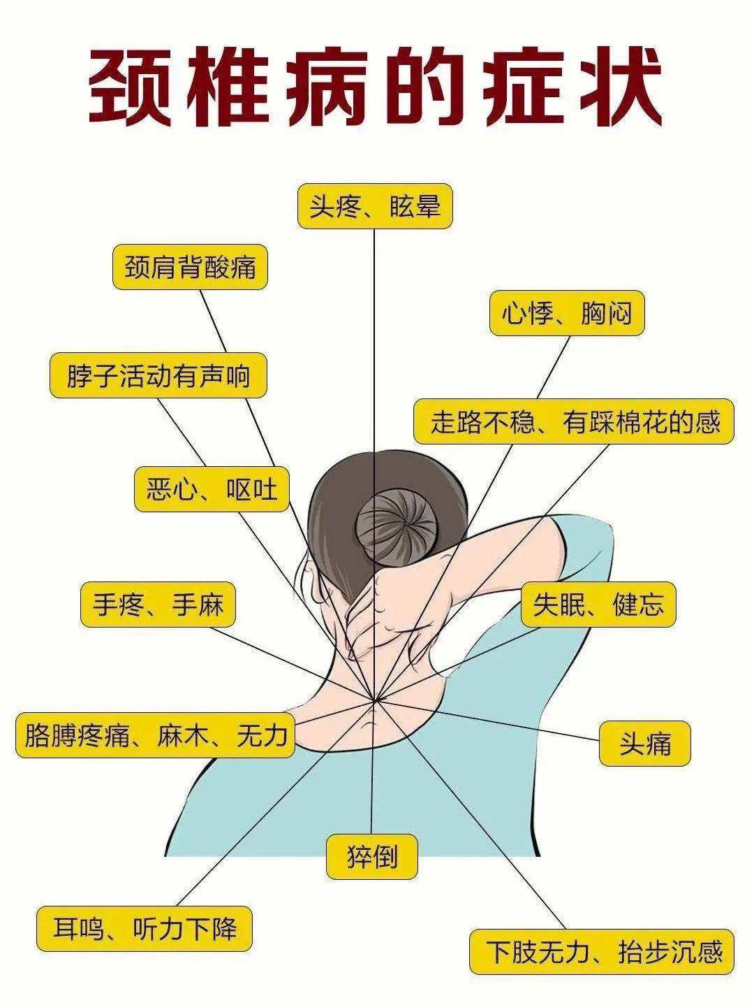 预警颈椎病!4招可缓解~_症状_动作_患者