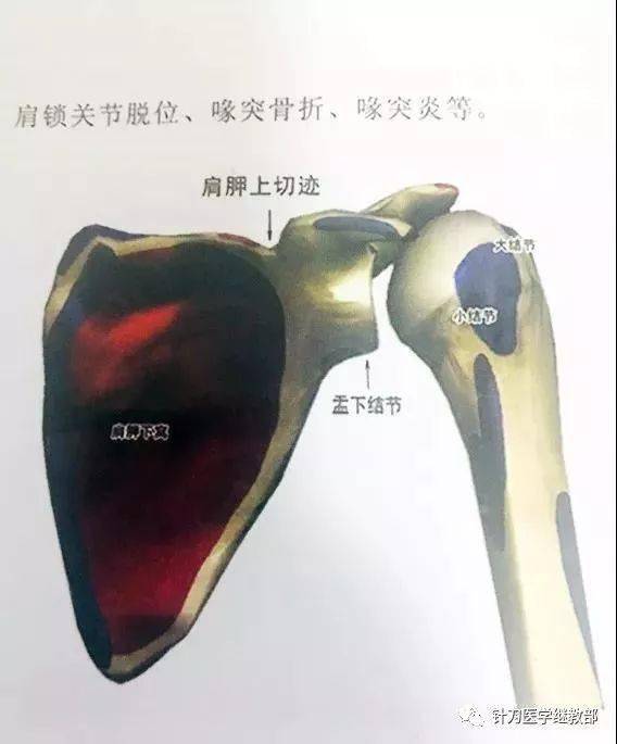 盂下结节和喙突_临床_肩胛骨_进展