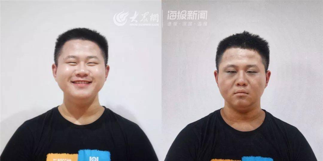 社交网站"毒虫仿妆"被追捧,然而现实吸毒者:牙齿脱落,五官坍塌,毒疮