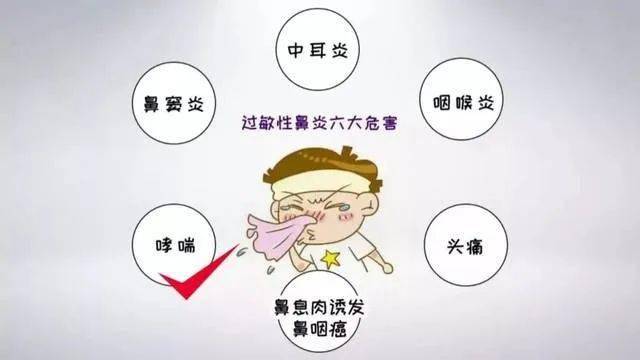 是过敏性鼻炎发作啦!_症状_患者_治疗