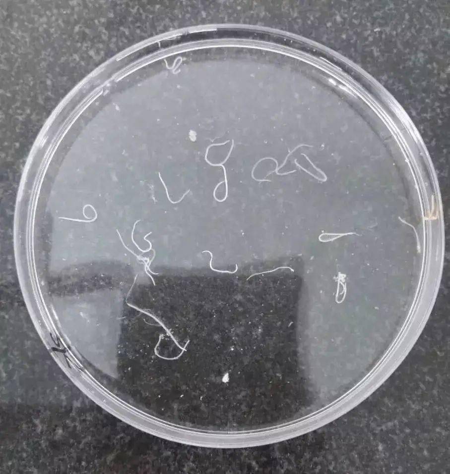 再给孩子吃这些,就是害他_肺吸虫_田螺_生鱼片