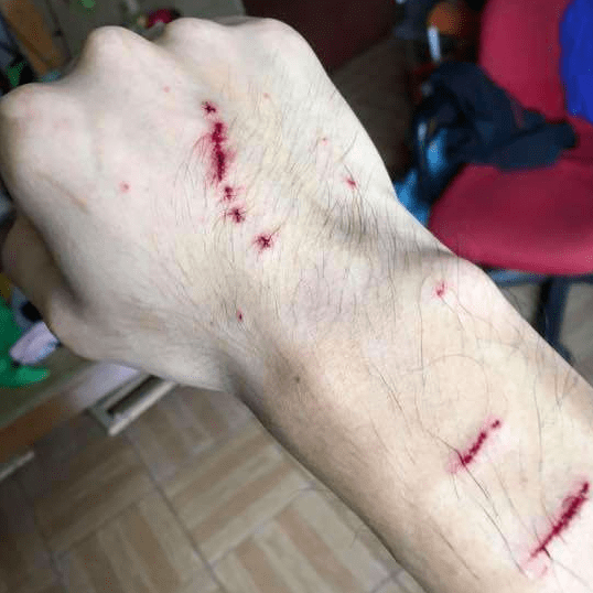 狗咬伤口皮肤特点图片