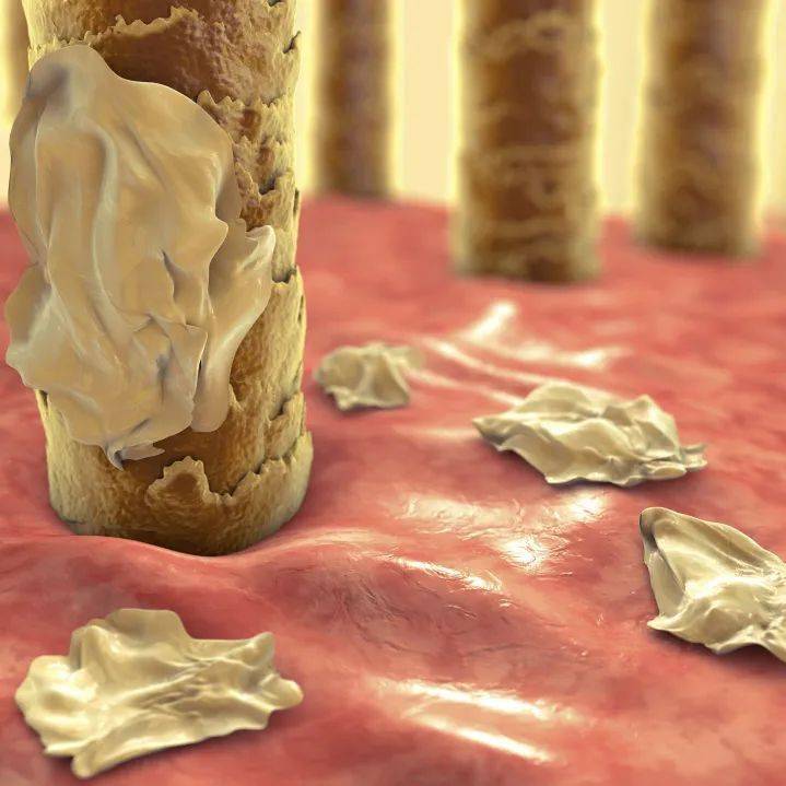 怎么,是我头皮不配吗?_护理_马拉_皮肤