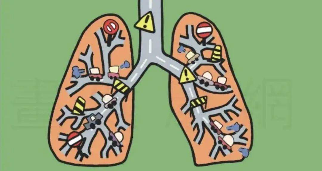 慢性阻塞性肺疾病,简称慢阻肺,是一种常见的慢性气道疾病,患者主要