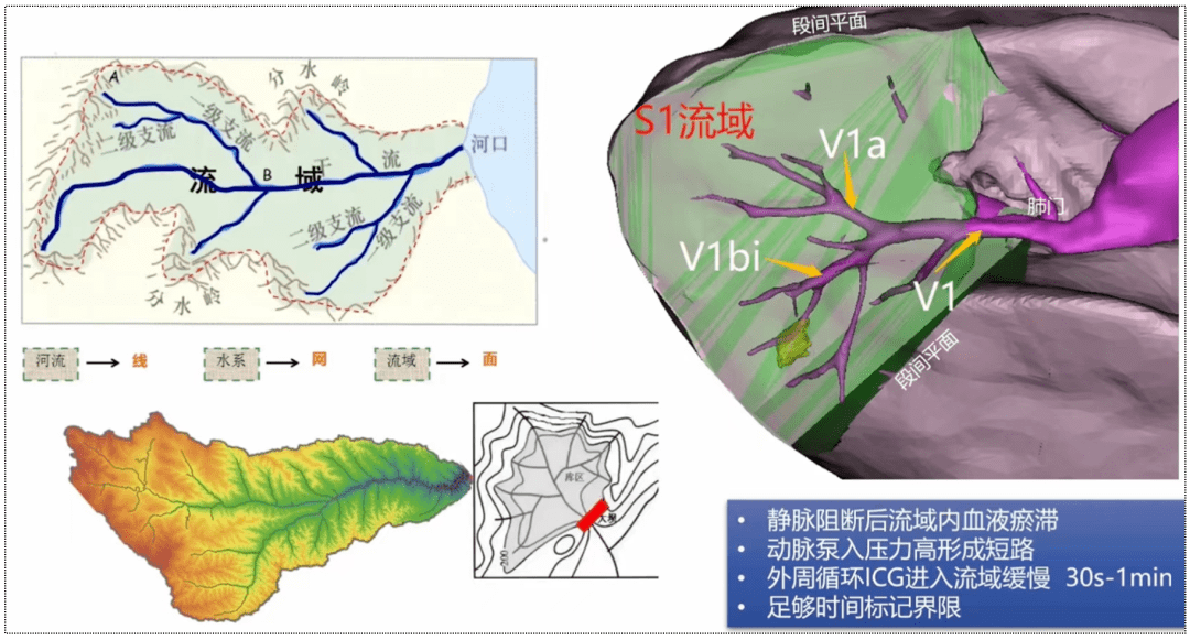 成熟简单高效,新的肺结节切除法 流域分析法_进行_右肺_解剖