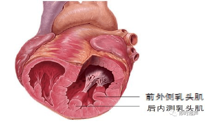 心肌梗死常見併發症超聲診斷_二尖瓣_心動圖_運動