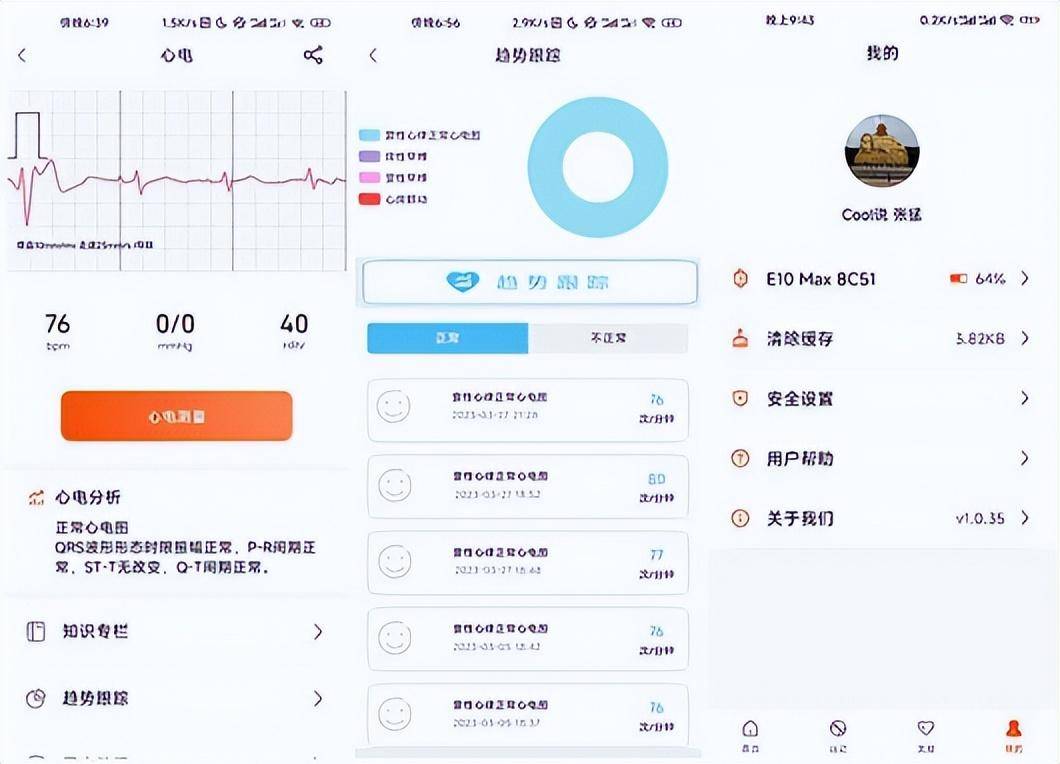 血压手表榜首，无创血糖心电的国产智能手表，dido E10S PRO亲测
