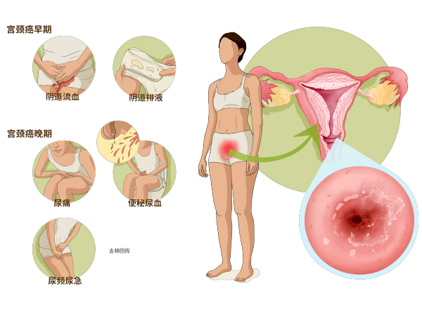 细胞学_检查_病变