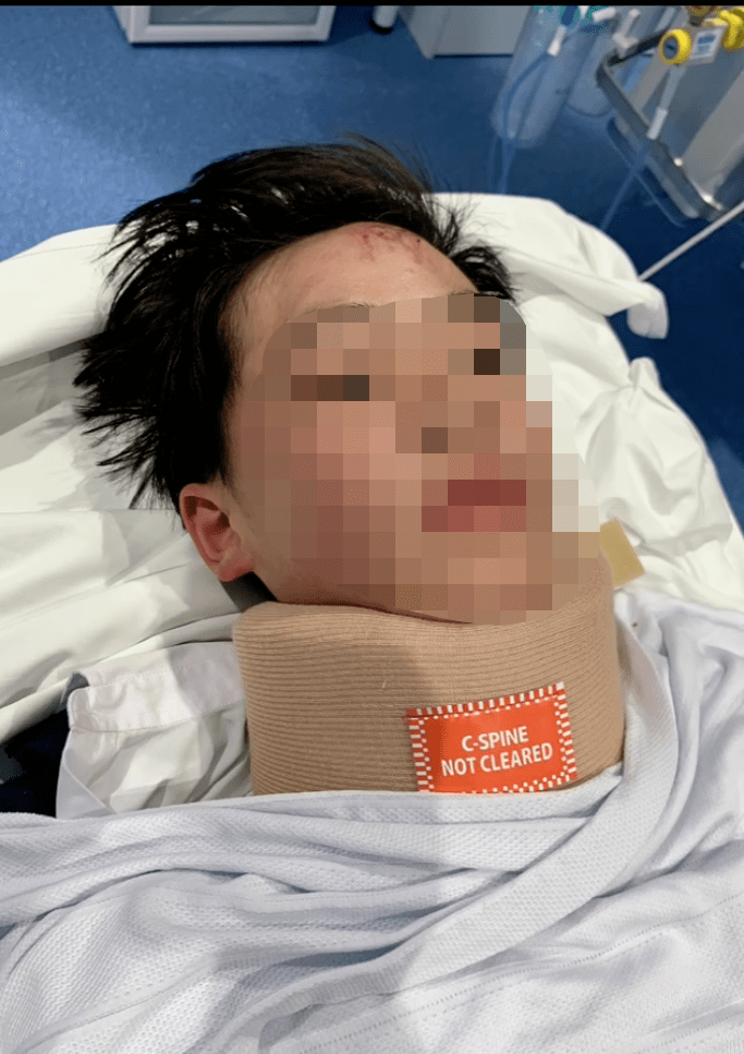 照片显示,受伤学生戴着颈托躺在病床上,他的额头和手背处都有明显的