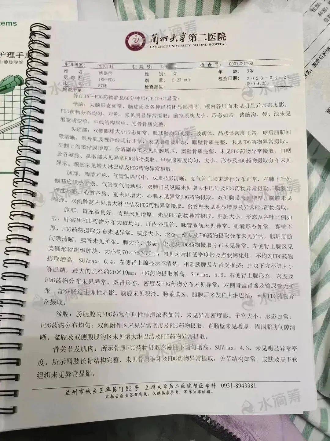 兰大二院诊断单照片图片