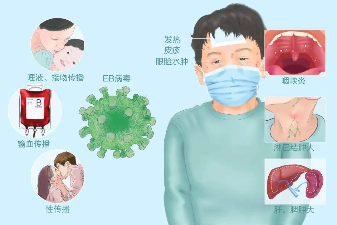 人类疱疹病毒6型等和可以导致幼儿急疹的单纯疱疹病毒,巨细胞病毒