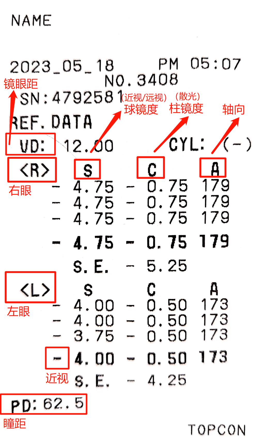 如何看懂验光单>>