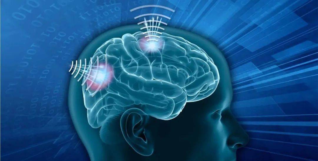 【科技】脑机接口,如何破解大脑的黑盒子?_意识_意图_信号