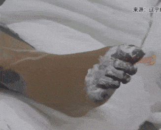 女孩充电时被“电击”,内脏受损,面临截肢!销售方:只能赔一个充电头_杨某今_网友_手术